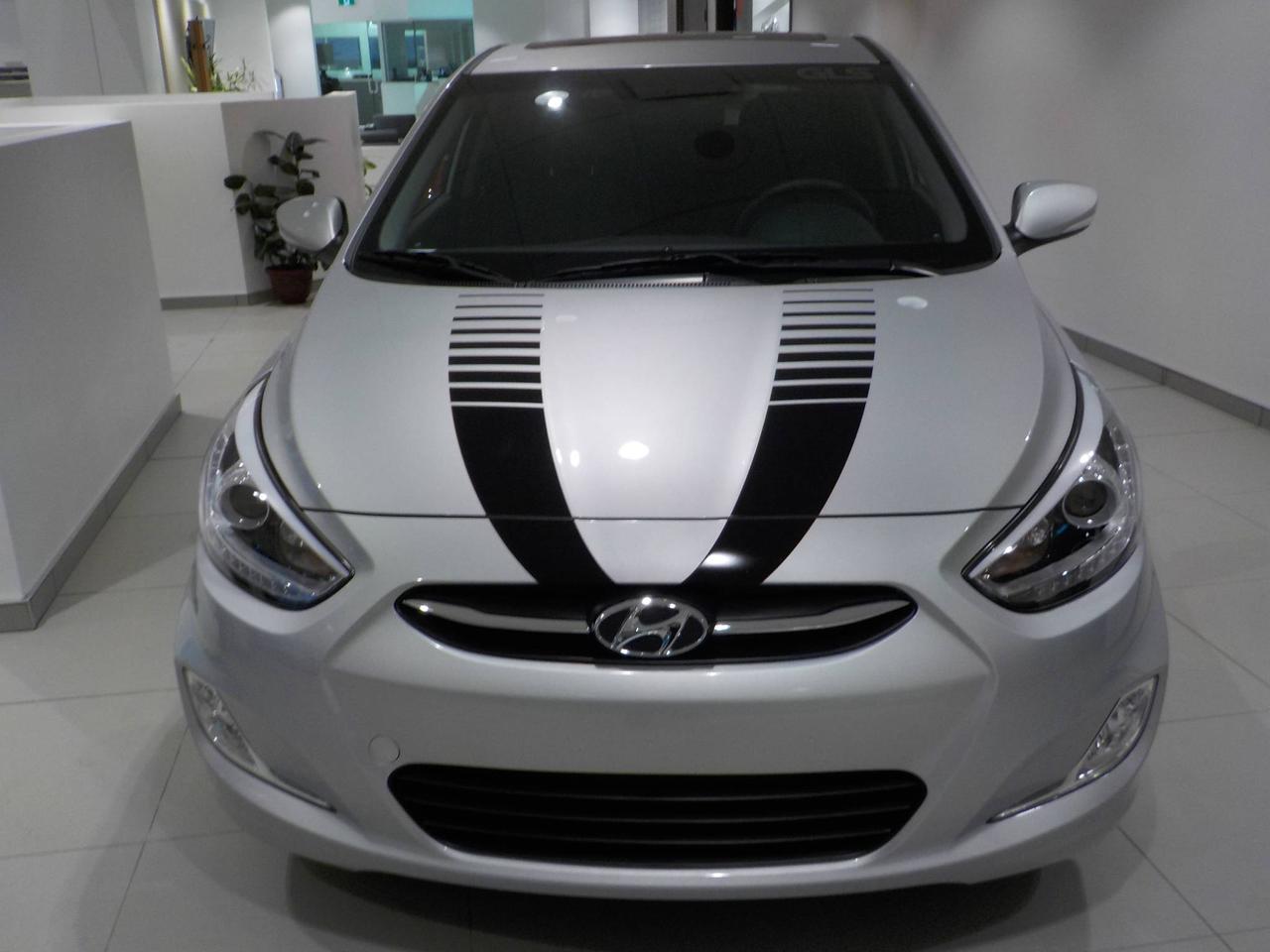 <a href=https://www.hyundairiviereduloup.com/occasion/Hyundai-Accent-2016.html>https://www.hyundairiviereduloup.com/occasion/Hyundai-Accent-2016.html</a>

MANUEL,A/C AUTOMATIQUE,CRUISE,MAGS,PHARE A BRUME,SIEGES CHAUFFANT,VITRES ELECTRIQUE,BARRURE DE PORTE A DISTANCE,MIRROIR ELECTRIQUE ET CHAUFFANT,TELEPHONE MAIN LIBRE,RADIO AM/FM/CD/XM/IPOD/USB.FINANCEMENT DISPONIBLE SUR PLACE.